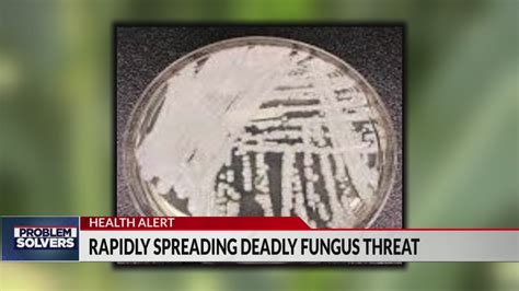 Rapidly spreading deadly fungus already in Colorado, presents 'urgent' threat